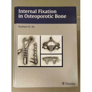 Yuehuei H. An - Internal Fixation in Osteoporotic Bone
